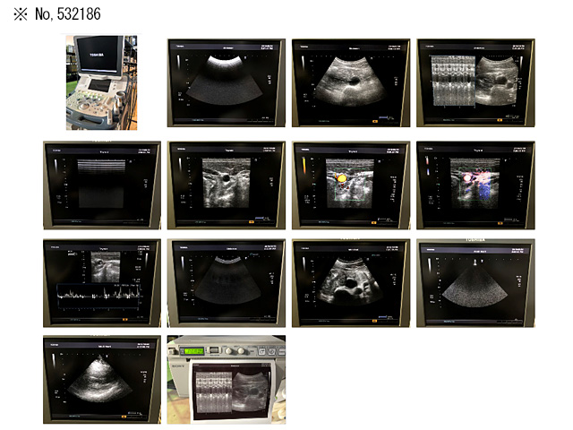 Ultrasound Xario SSA-660A TOSHIBA | Used Medical Equipment Supplier in