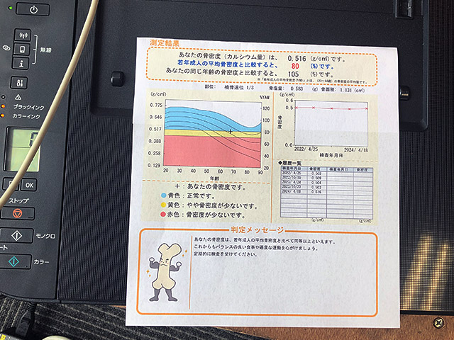 骨密度測定装置 ALPHYS A 日立製作所 | 中古・新品の医療機器